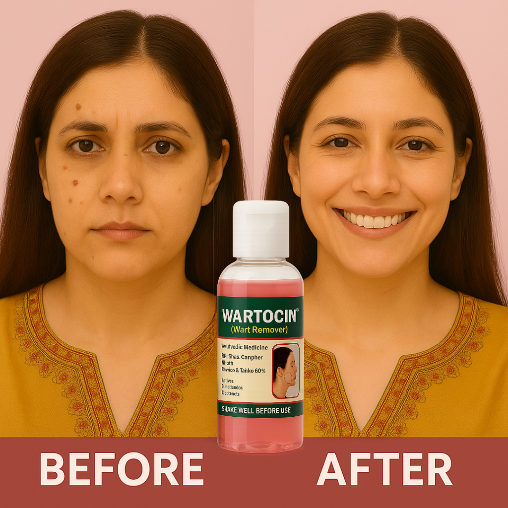 Wartocin Wart & Skin Tag Remover - 30ml