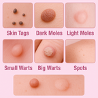 Wartocin Wart & Skin Tag Remover - 30ml