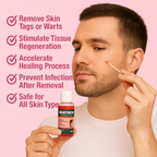 Wartocin Wart & Skin Tag Remover - 30ml