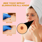 Wartocin Wart & Skin Tag Remover - 30ml