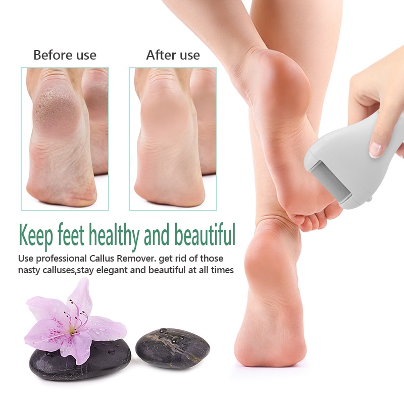 Rechargeable Callus Remover