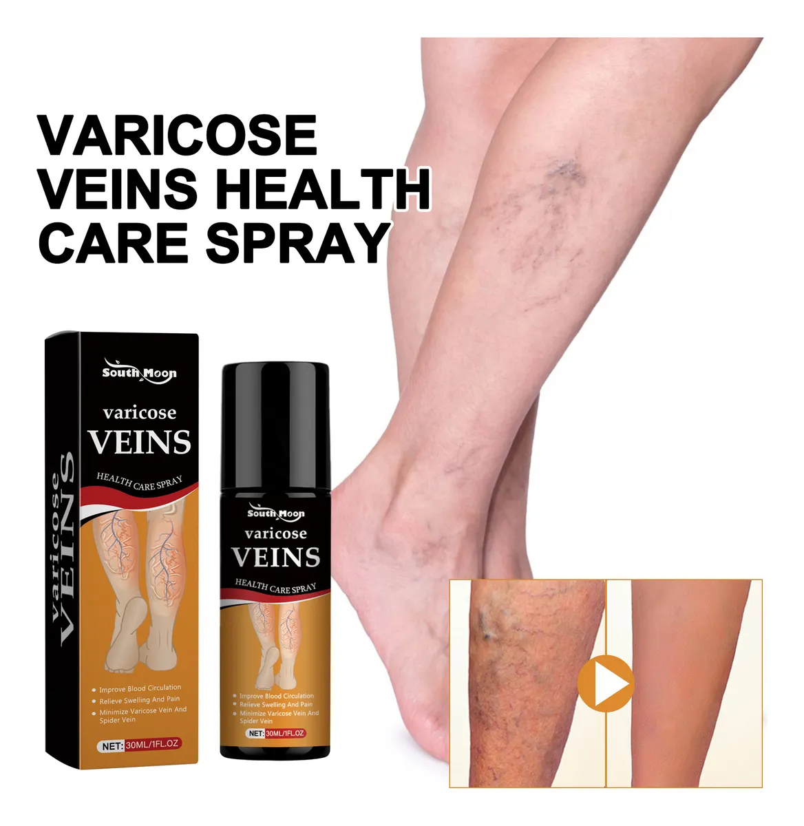 Varicose Veins Relief Herbal Spray - (Buy 1 Get 1 FREE🔥🔥)