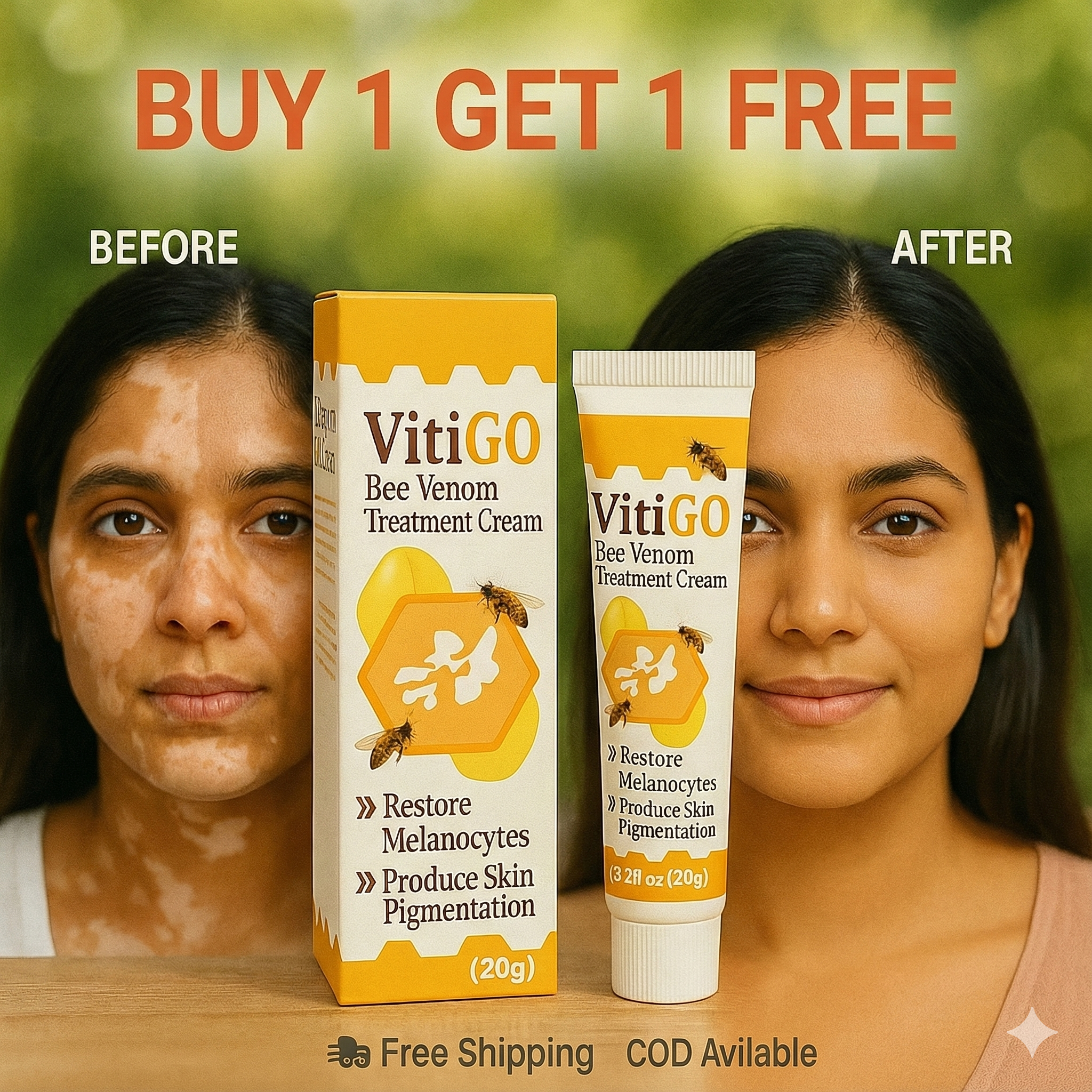 VitiGO™ Vitiligo Corrector Cream - BUY 1 GET 1 FREE 🔥