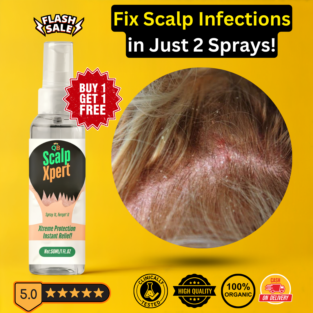 ScalpXpert Anti Fungal Scalp Spray - Buy 1 Get 1 Free🔥🔥