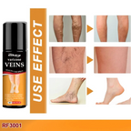 Varicose Veins Relief Herbal Spray - (Buy 1 Get 1 FREE🔥🔥)
